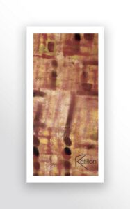 Stardom player, peinture acrylique art contemporain